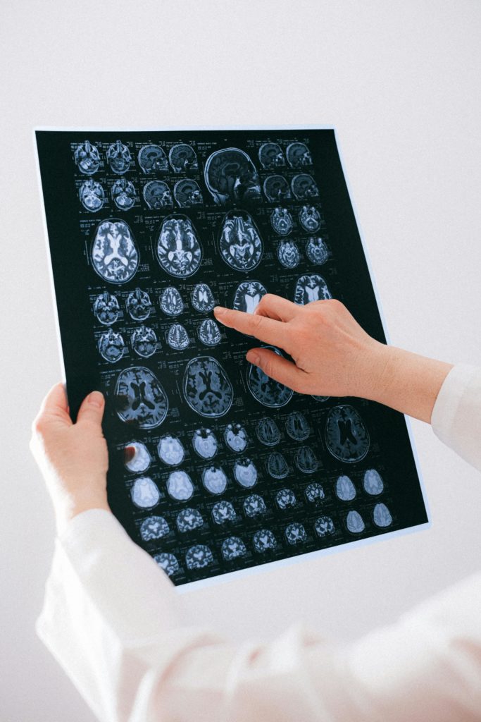 brain aneurysm modern interior aesthetic professional photography.png