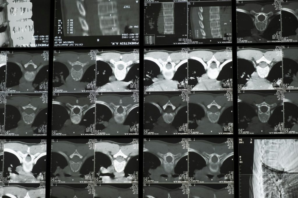 spine anatomy modern interior aesthetic professional photography.png
