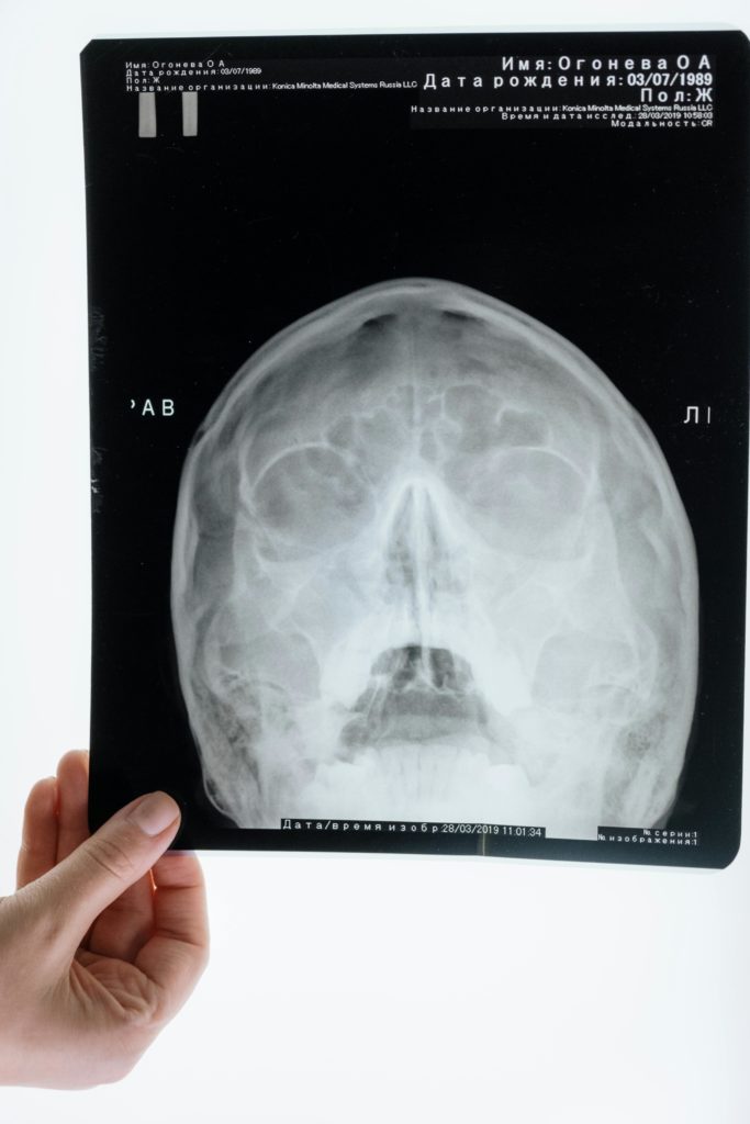 sinusitis anatomy modern aesthetic professional photography.jpg